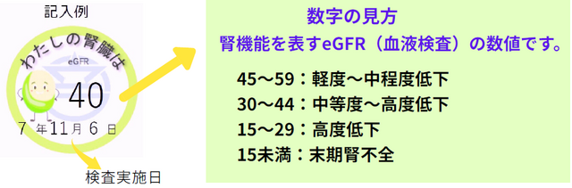 CKD数字の見方